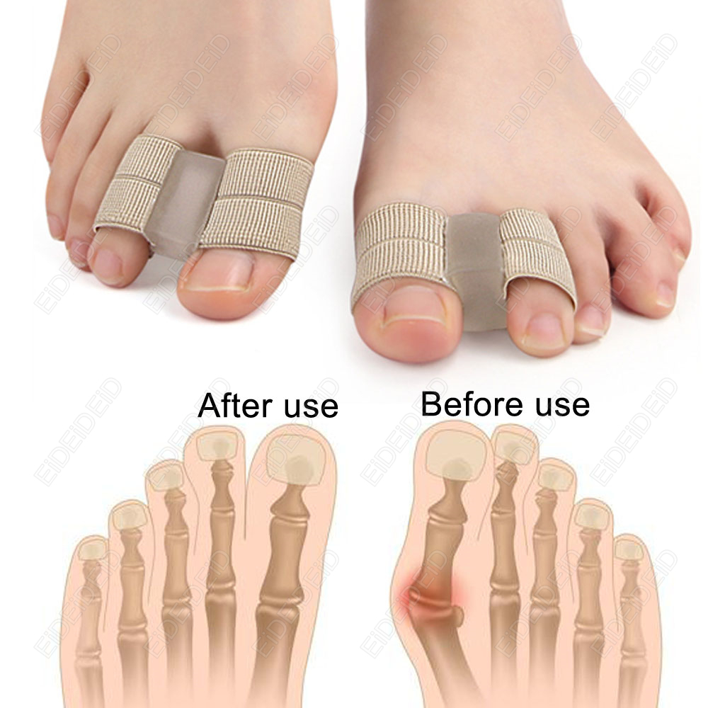 Bunyon ayak parmağı Düzeltici  - Women'S Shoes With Bunions incelemesi ve fiyatı